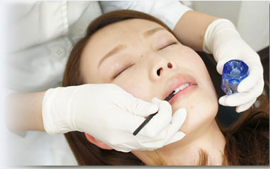 しみ止めのお薬を塗布